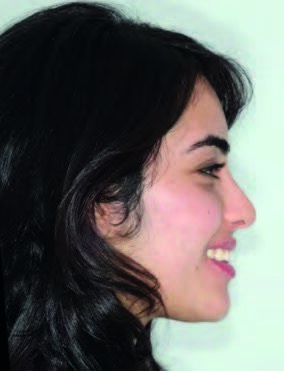 Smile before treatment