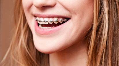 App van promovenda zorgt voor betere mondhygiëne beugelende tieners