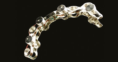 Overdenture su 4 impianti con utilizzo di attacchi OT Equator con barra passivata da elastic seeger