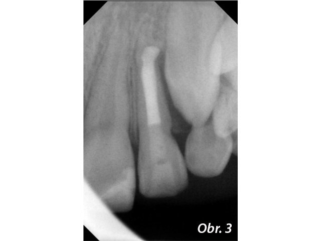Obr. 3: září 2009 – tzn. za rok a 4 měsíce
