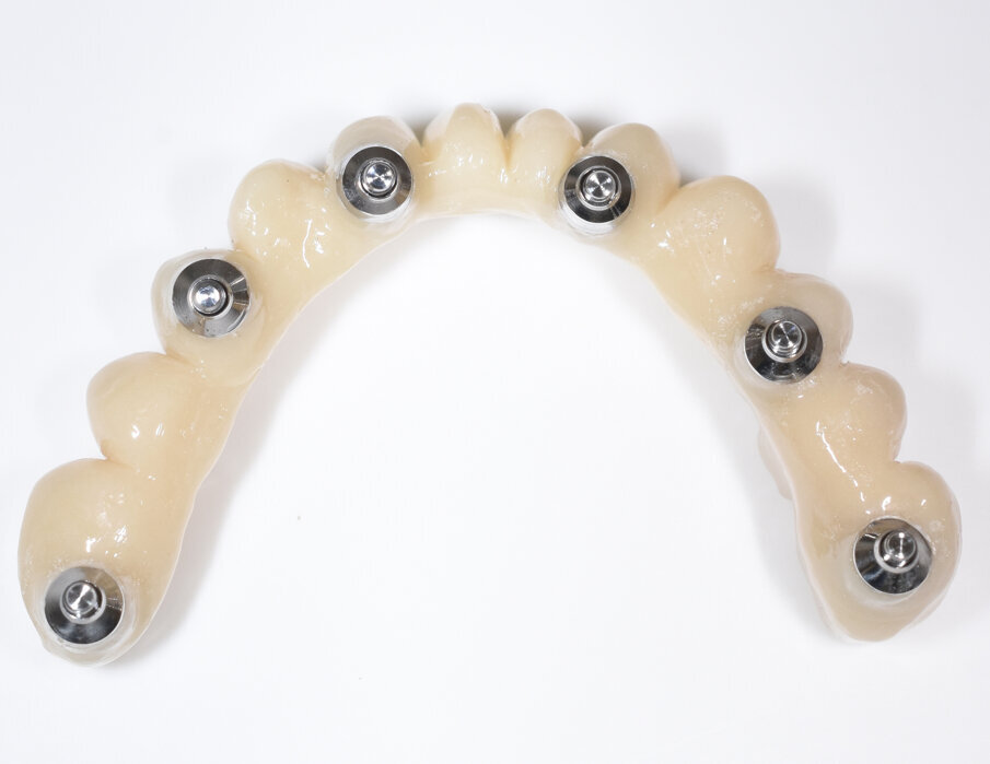 Fig. 20 - Visione occlusale provvisorio.