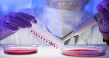 Pesquisadores de Odontologia completam teste de HIV para uso no mundo em desenvolvimento