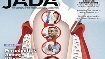Prevalencia de periodontitis en hispanos en EE UU
