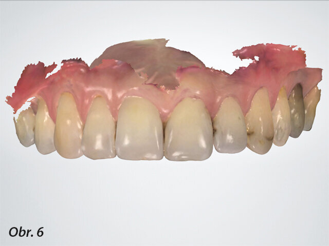 Obr. 6: Digitální otisk.