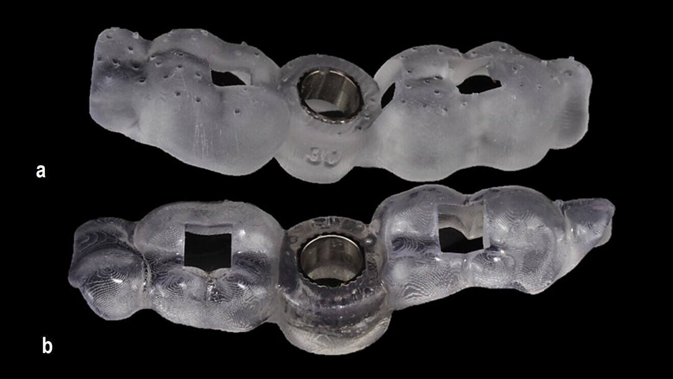 Figs. 3a & b: Surgical guide with a fitted sleeve. Straight from the printer (a). After post-processing (b).