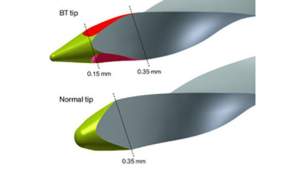Instrumentación radicular biológica y conservadora