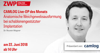 CAMLOG Live-OP am 22. Juni ab 14.00 Uhr