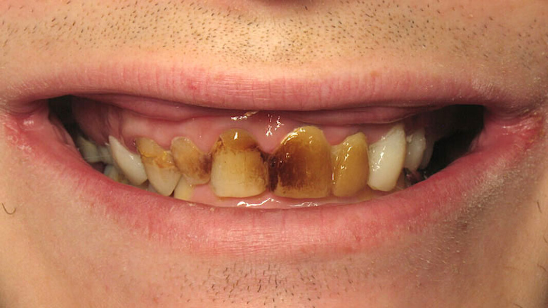 Figura 1. Situación inicial.