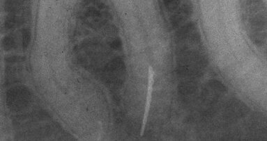 A critical assessment of endodontic armamentarium