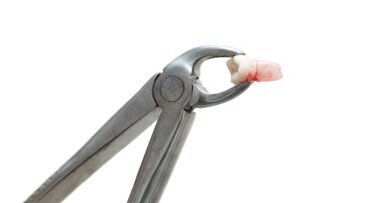 Nieuw onderzoek mogelijke doorbraak in regeneratieve tandheelkunde