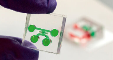 Individualisiertere Zahnheilkunde mit „Tooth-on-a-Chip“