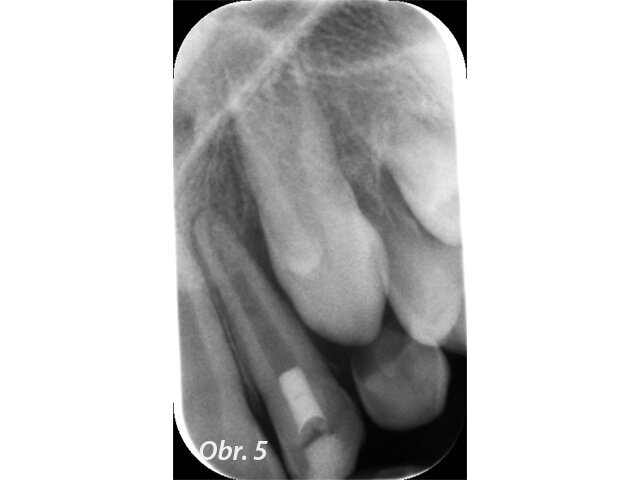 Obr. 5: Po ošetření