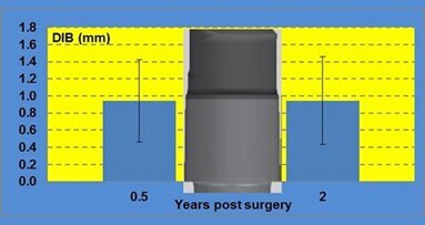 Performance clinique et radiologique des implants courts (L 6,5 mm). Résultats d’une étude clinique incluant un suivi de 2 ans