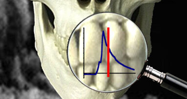 Putting teeth into forensic science