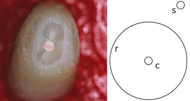 Les dentistes sujets à une illusion d’optique