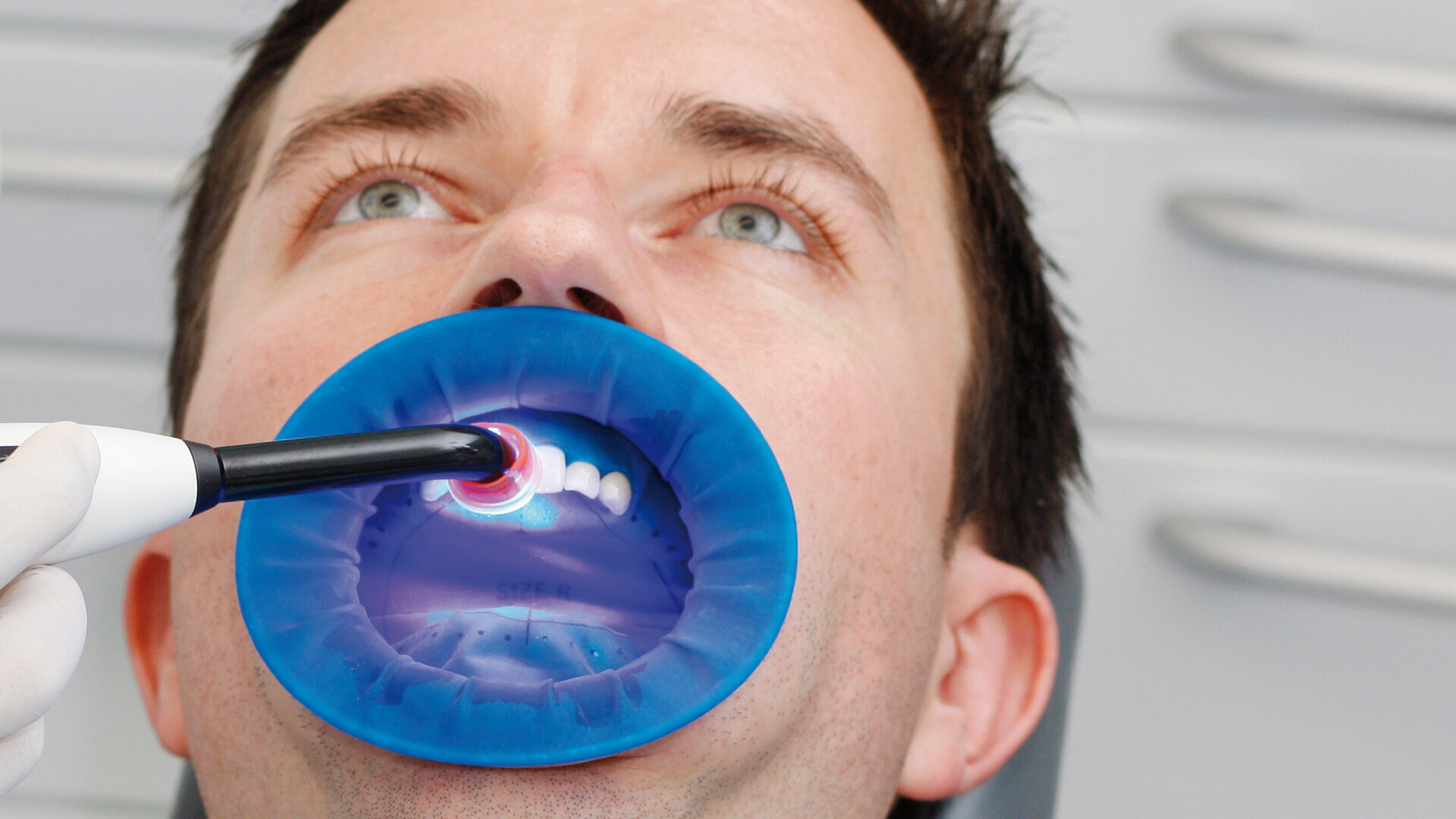 Entretien avec le Dr Richard Price : L'importance d'une lampe à photopolymériser de haute qualité