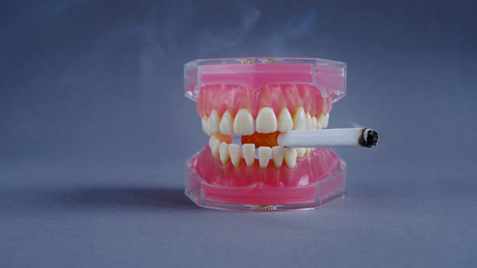 Uticaj elektronskih cigareta, cigareta, vodene lule i bezdimnog duvana na zubne implantate