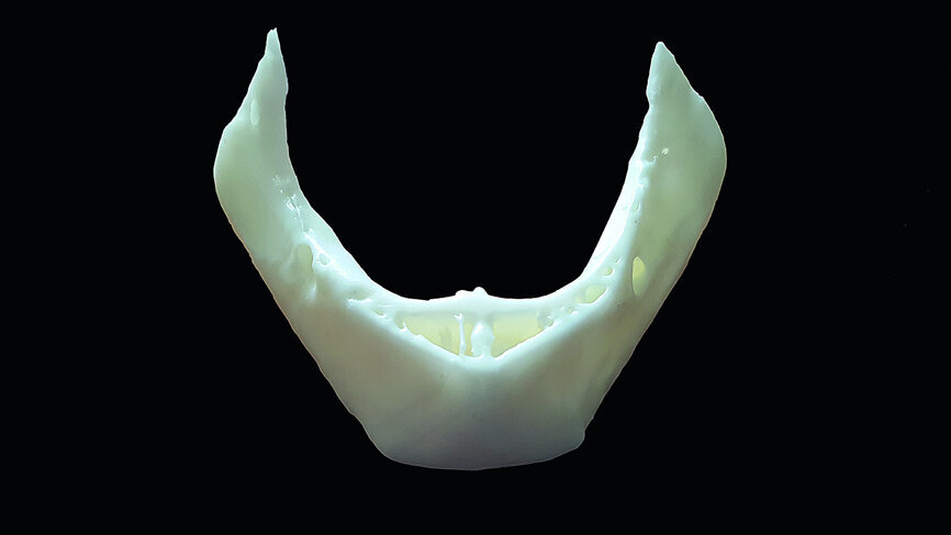 Fig. 22b: The virtual surface model (a), and the actual 3-D printed model (b).
