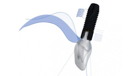 Dentsply Sirona – ASTRA TECH Implant System EV