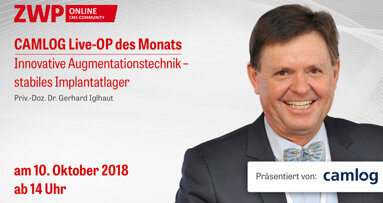 CAMLOG Live-OP am 10. Oktober ab 14 Uhr