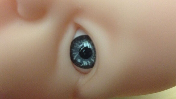 Little progress recorded in historical cleft lip and palate treatment