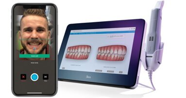 Benefits of Invisalign Smile Architect