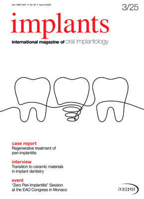 implants international No.3, 2025 implants international No.3, 2025