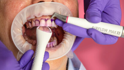 Tehnologia Airflow: cel mai bun AIR-FLOWING posibil Tehnologia Airflow: cel mai bun AIR-FLOWING posibil