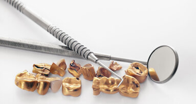 Oude kronen hebben grote waarde, maar hoeveel precies?