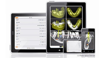 Consegna della guida chirurgica più rapida e senza intoppi per una migliore esperienza da parte del cliente