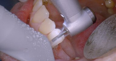 Más potencia, menos estrés y más diversión