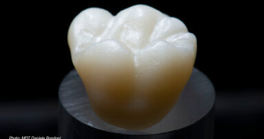 KATANA Zirconia YML: Reinventing multilayered zirconia