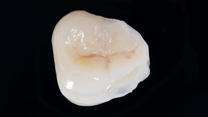 Funkční, anatomická a estetická harmonie s novým kompozitem Enamel Plus HRi Bio Function