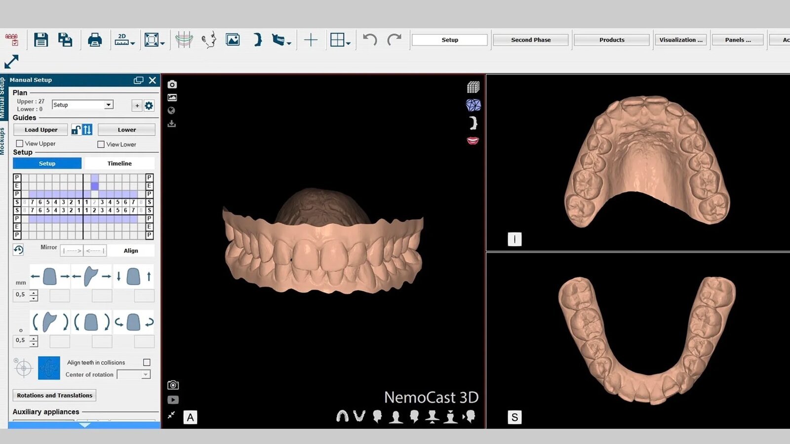La planificación digital de la Ortodoncia en el Máster de USC