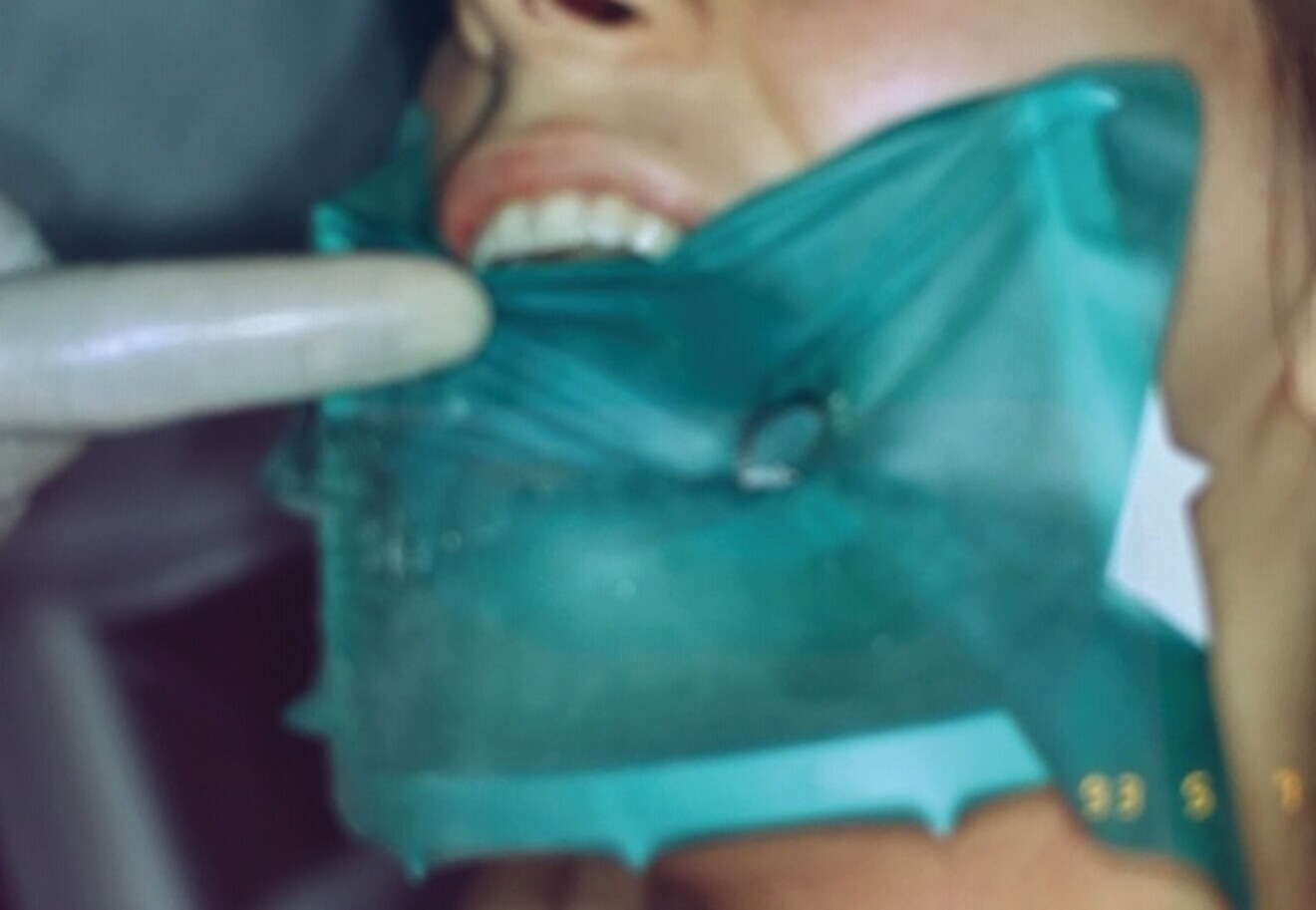 Fig. 2 : Cadre ouvert. Cadre HYGENIC.