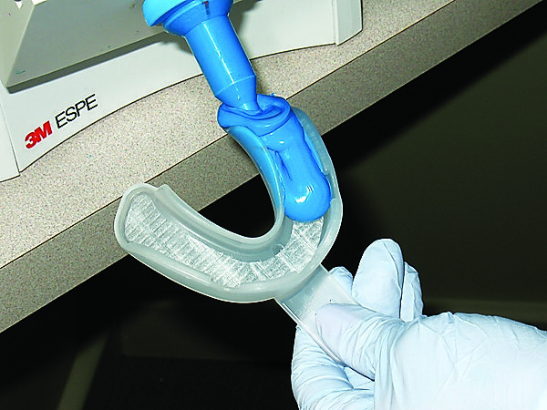 Fig. 8. Loading 3M Imprint 4 material into the 3M Impression Tray using a 3M Pentamix 3 Automatic Mixing Unit