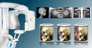 Questions les plus fréquentes concernant Planmeca ProMax 3D – Unit tout en un répondant à tous les besoins de l’imagerie