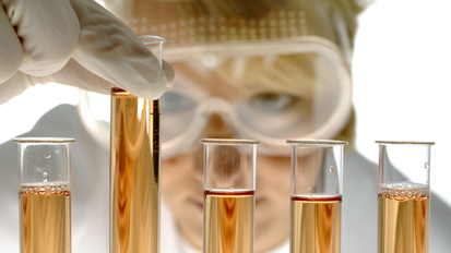 Durchbruch bei Parodontitisforschung Durchbruch bei Parodontitisforschung