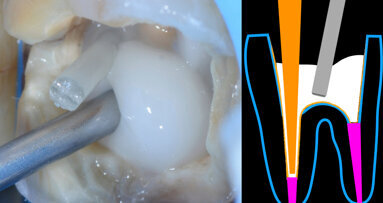 Der Vorteil von Bioaktivität: Bessere Ergebnisse durch biochemische Stimulierung