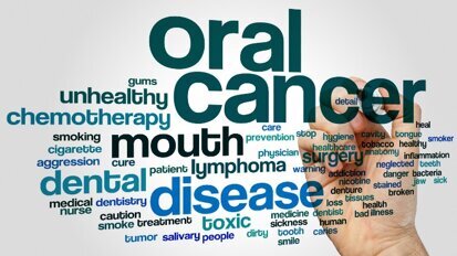 Oral Cancer Day: la prevenzione è sulla bocca di tutti