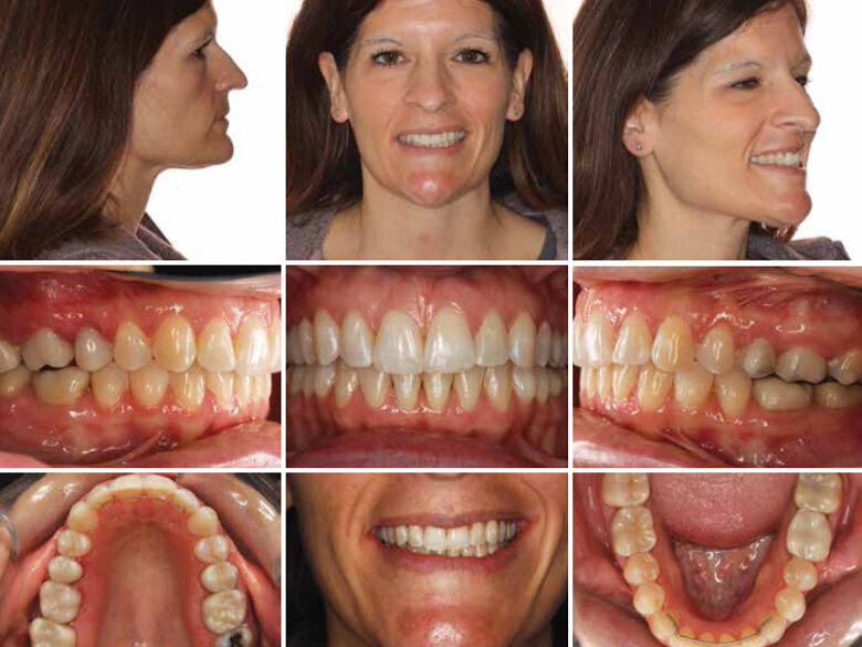 Fig. 4: Initial records. (Photos: Michael J. Mayhew, DDS, MS, MS, & Nicole R. Scheffler, DDS, MS)