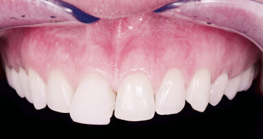 Umění personalizovaného smile designu