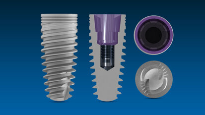 Mini-fellowship in implant dentistry to be offered at University of Miami