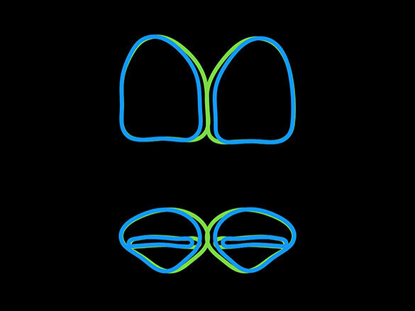 Figura 4. Formas de incisivos centrales reales e ideales.