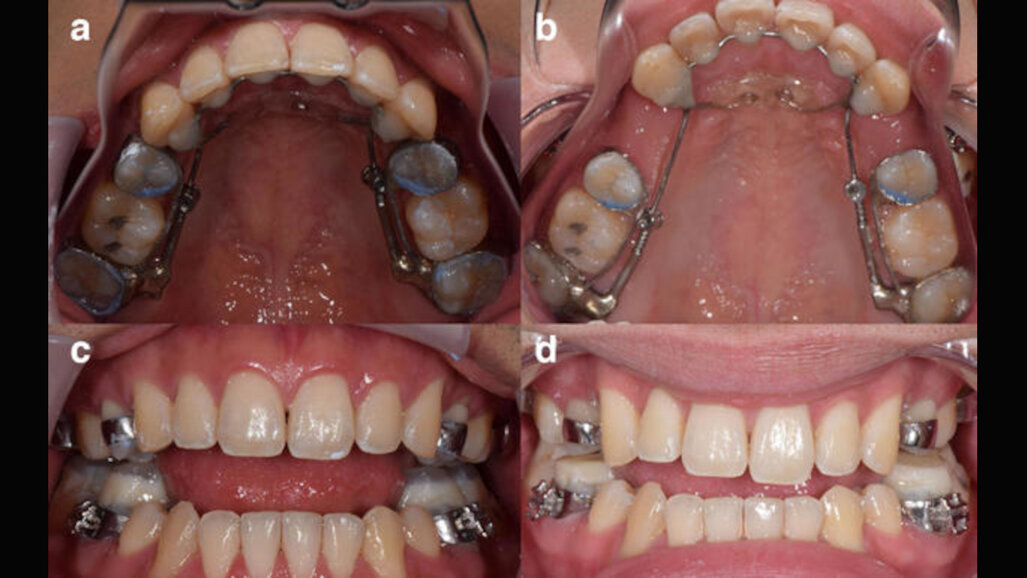 Creator of Anterior Growth Guidance Appliance is now under federal investigation