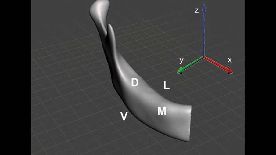 Fig. 1a_Modello della mandibola destra, b) sezione utilizzata per l’analisi FEM.