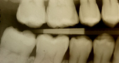 Armonia estetica funzionale e posturale con il nuovo materiale Enamel Plus Hri Bio Function