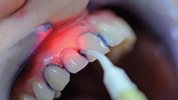 Klucz do terapeutycznego i ekonomicznego sukcesu