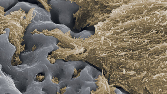 TiUnite: un biomateriale esclusivo