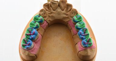 Koncept modelace okluze a sofistikované estetiky v digitální stomatologii. O krok blíže přírodě